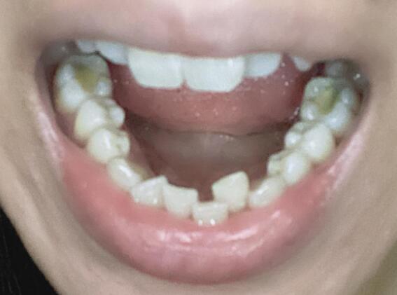 30幾40歲先走去cool箍牙過程分享屯門篇 U Blog