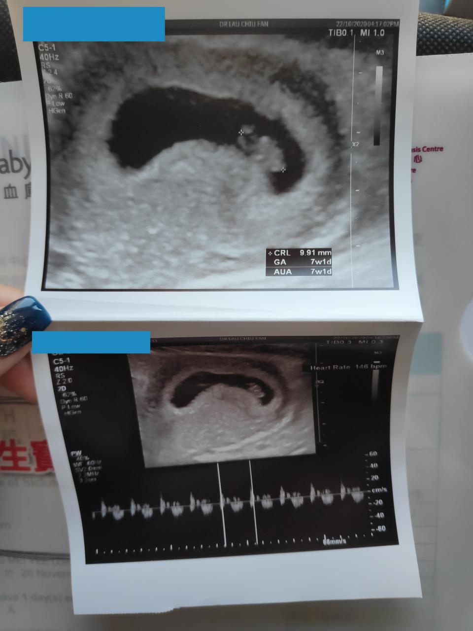 階段性懷孕檢查- U Blog