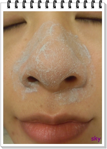 自家試用 掃走士多啤梨鼻 Holika Holika Blackhead Sponge Hot Scrub And Peel Off Mask U Blog