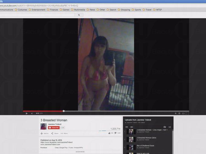孰真孰假？美國女子隆乳隆出三個乳房