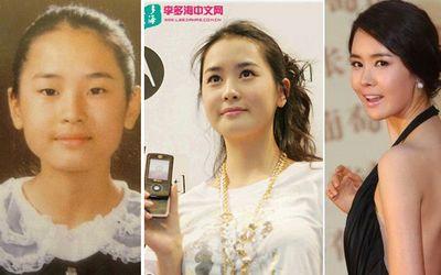 ４招教妳分辨「整容」與「天然」