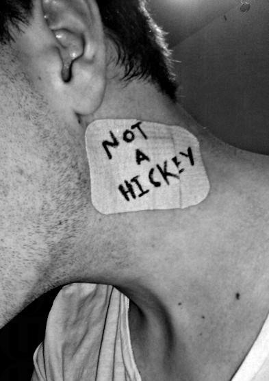 如何消除頸上留下的「咖喱雞」 如何消除頸上留下的「咖喱雞」