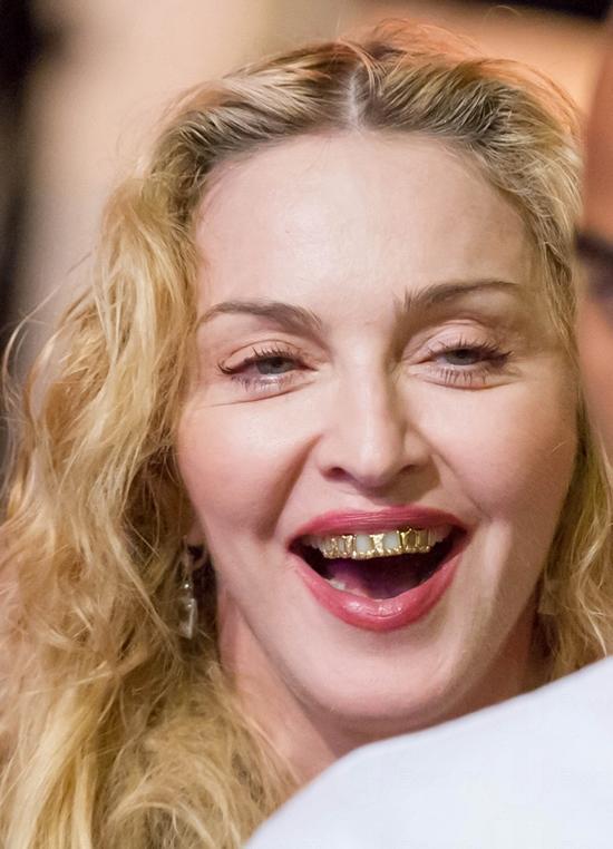 Modonna一向做開帶領潮流的角色，早前她跟男友Brahim Zaibat現身法國Menton音樂節時，一排金牙閃閃生輝。這排金色牙套除了以純金打造，仲鑲了24顆鑽石！英國報章笑謔她要為這牙套請保鏢！