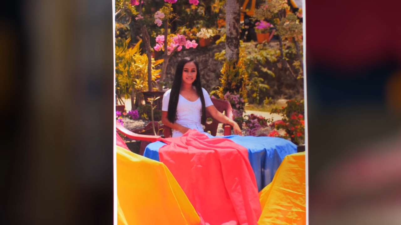 16歲選美女生患衰老症驚現60歲老人樣！兩年間全身長滿皺紋！醫生：「此病無法逆轉」！