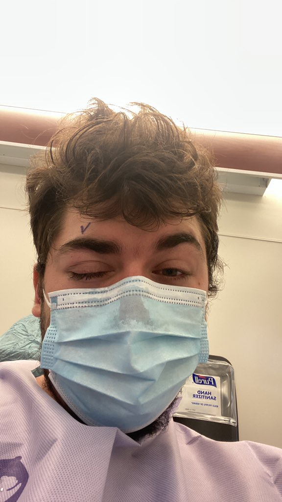 戴隱形眼鏡小睡40分鐘醒後險變盲！角膜混濁、視力模糊劇痛！5大情況不宜佩戴！