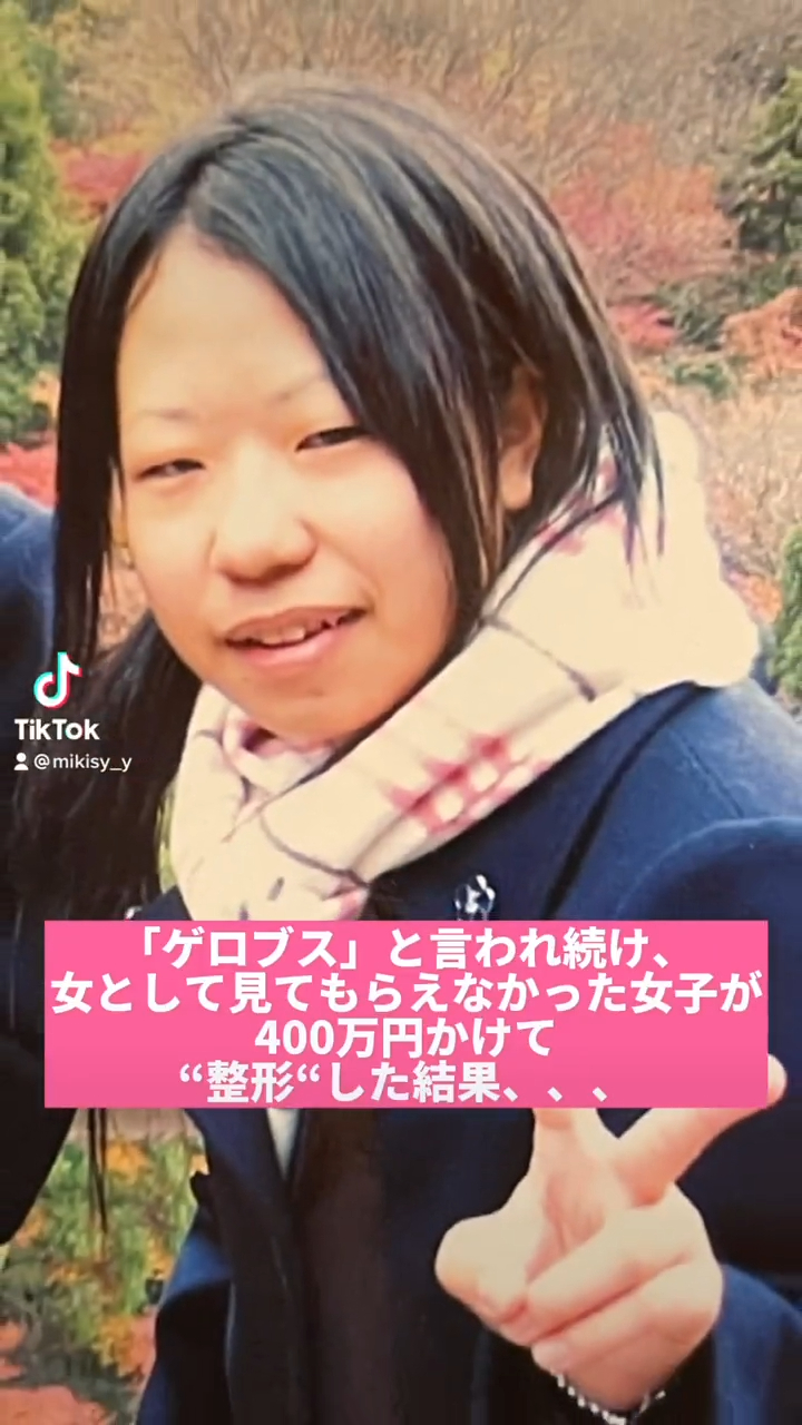 日本醜女被欺凌後豪花400萬整容！改頭換面後人生大逆轉！撞樣有村架純＋子瑜！