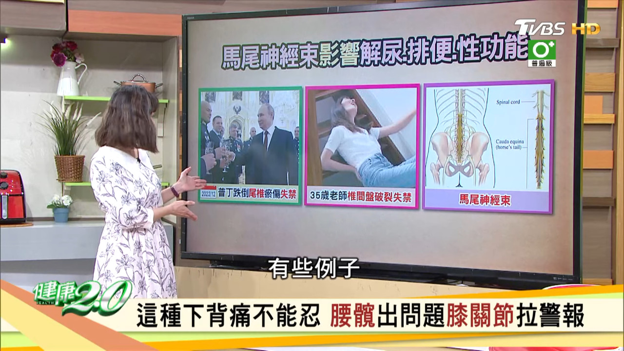 34歲女樓梯跌倒大小便失禁1年！屁股麻木、性功能恐癱瘓！醫生：1情況不要躺下！