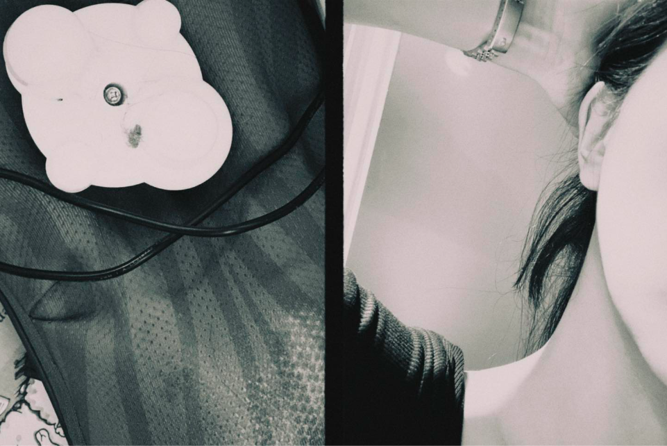 女星用肩頸按摩器出意外捲入頭髮！被扯走頭皮劇痛長髮全剪掉！發文警世要小心「這裡」！