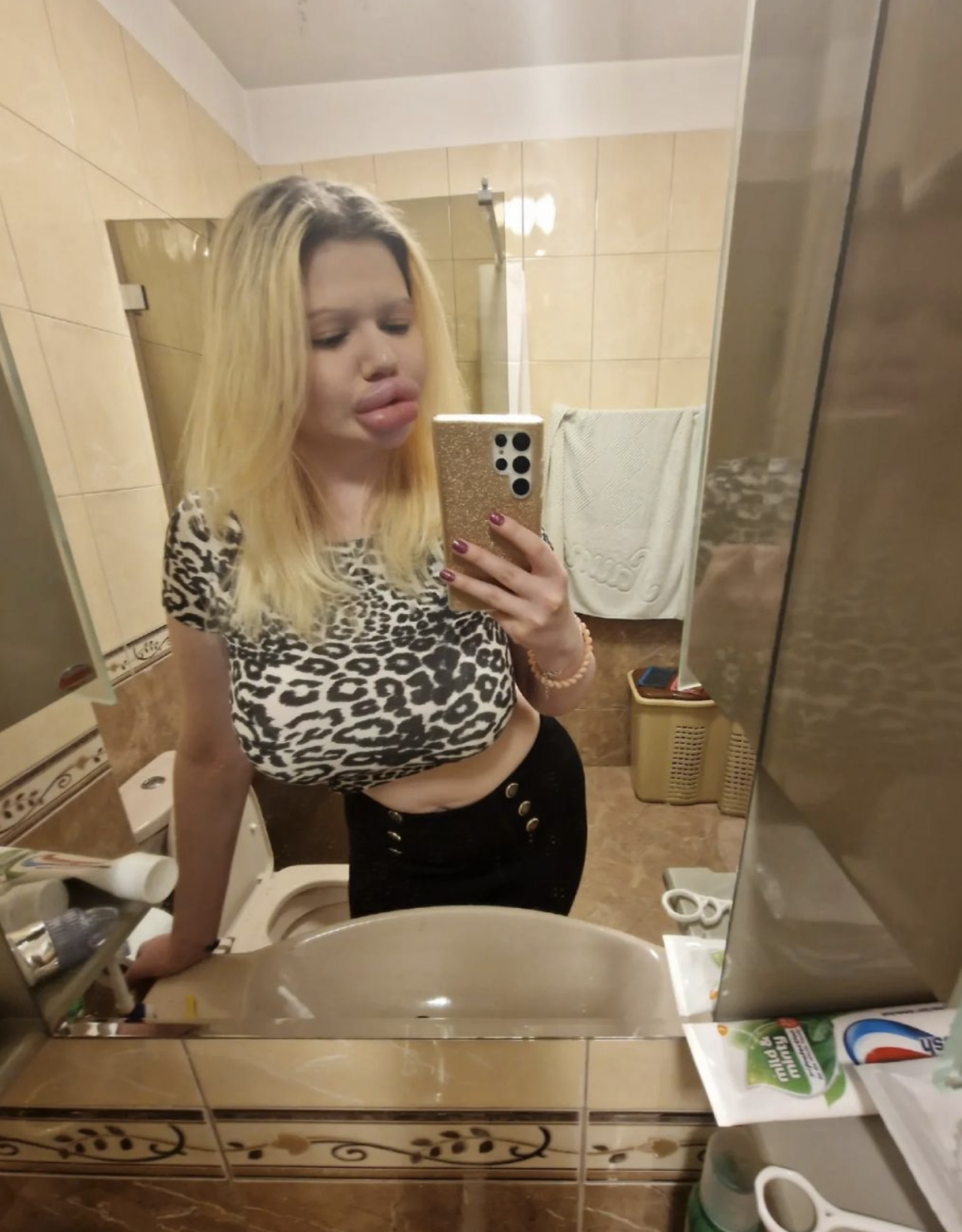 「真人版Barbie」為夢想動刀43次！整容4年花至少2萬美鎊！醫生警告「孖潤腸嘴」或致命！