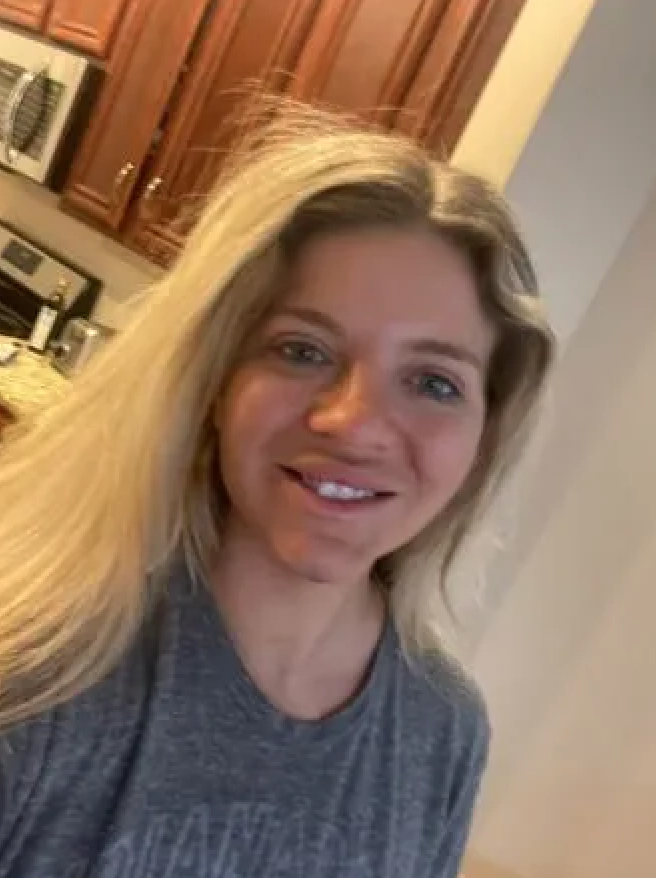 美國女生下巴微整形竟變卡通人物！術後一年才回復正常！網民：應該退款！