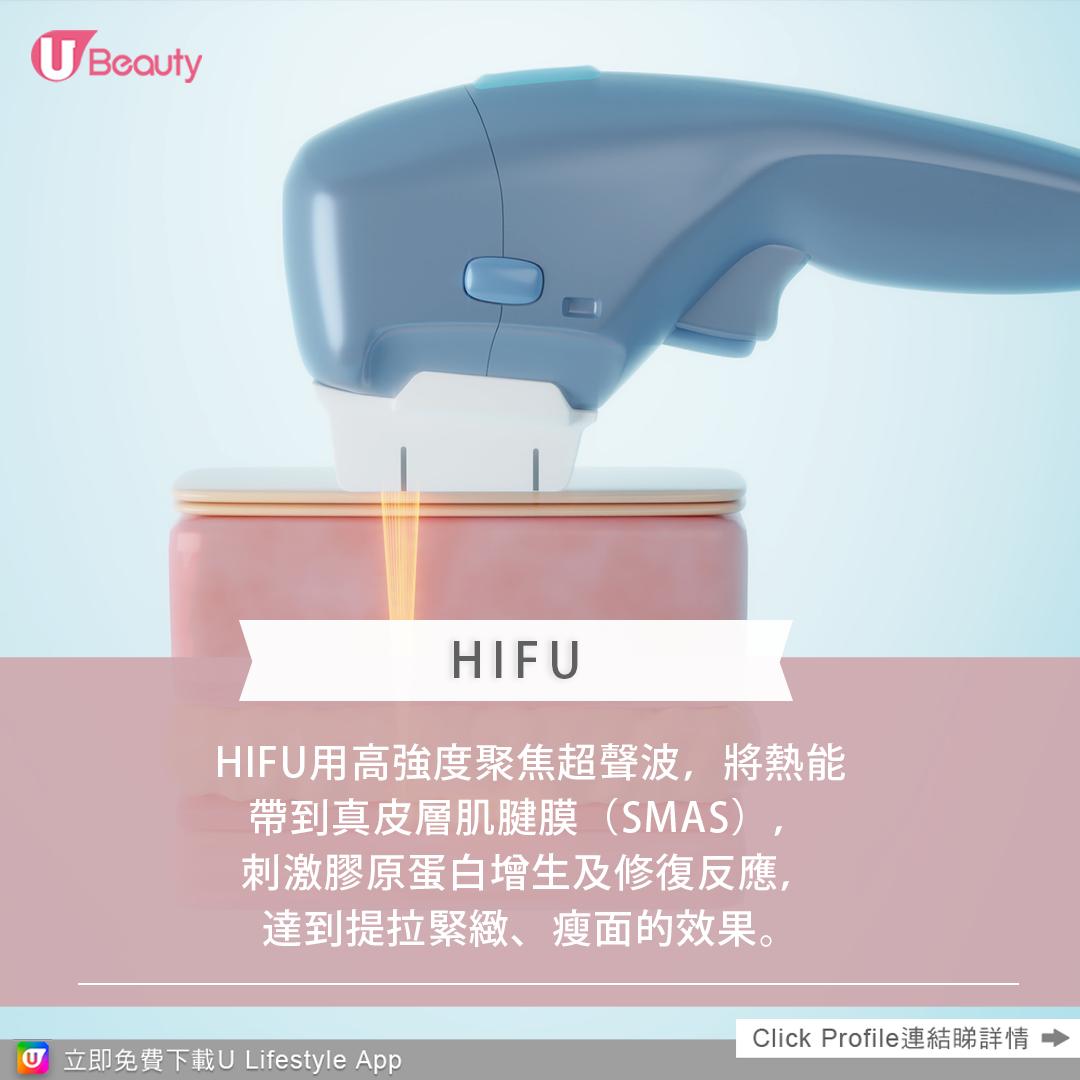 瘦面療程大比拼！HIFU/ Thermage/ Botox/ 無針埋線/ 啪骨比較懶人包