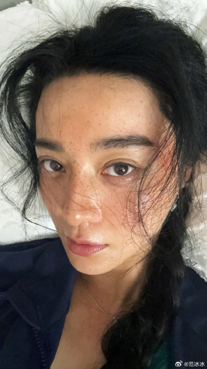 范冰冰零濾鏡真實近照曝光！滿佈黑斑疑似燒傷嚇壞粉絲？