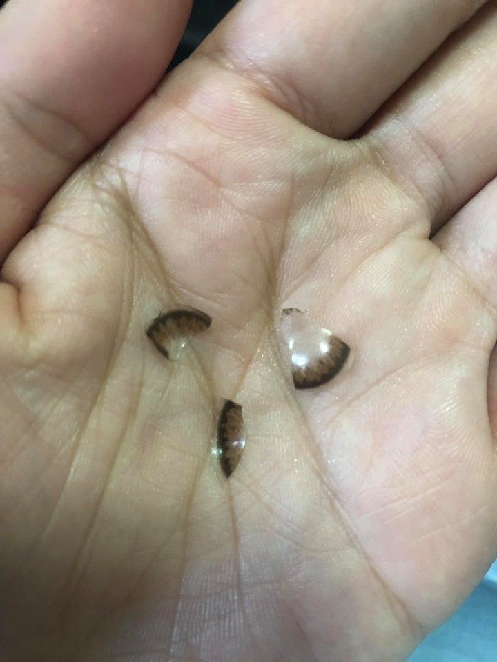 台少女配戴隱形眼鏡捽眼致鏡片碎裂！內附眼科醫生6大建議