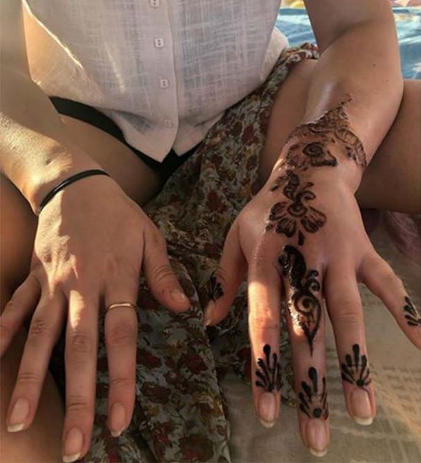 【附皮膚科醫生3大建議】澳女試玩Henna彩繪紋身 手部嚴重灼傷險截肢