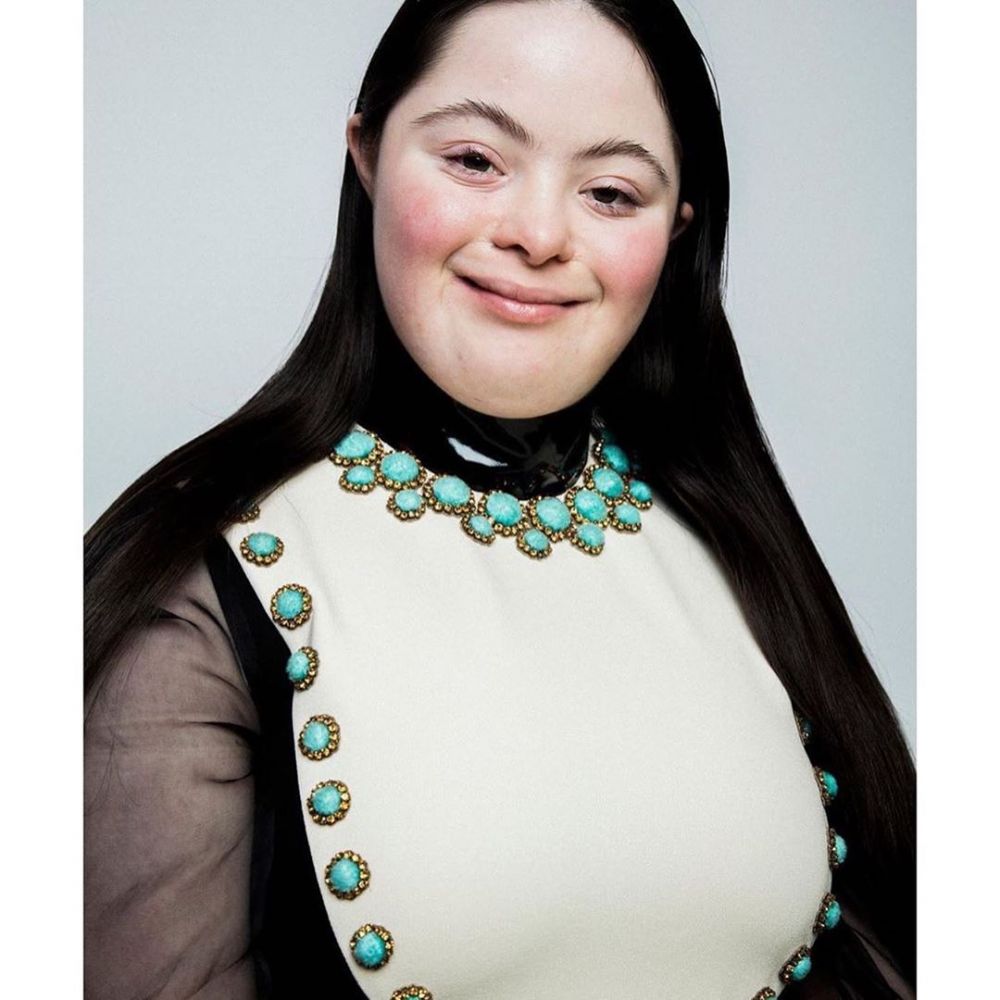 展現自信美！唐氏綜合症女生成GUCCI睫毛膏模特兒！登上時尚雜誌《VOGUE》一圓model夢！