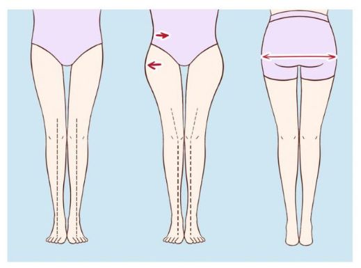 【假外胯】Coffee教你3大改善假外跨方法！原來要加強訓練背部/臀部肌肉？一定要戒掉這壞習慣！