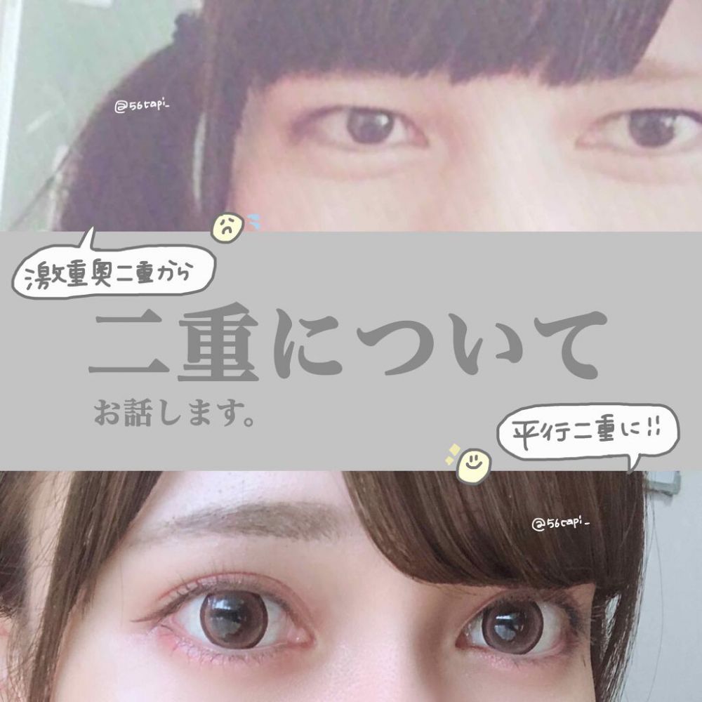 日本女生分享零開刀變雙眼皮方法！全靠維持這2個習慣！效果好像整容！