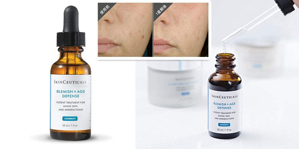 【2021最新】10款弱酸性護膚品推介！果酸煥膚注意事項！針對黑頭/毛孔粗大/美白！