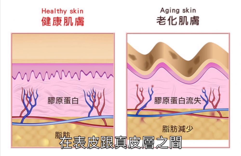 【25+年輕肌】台灣皮膚科醫生：肌膚老化原因+症狀！常食炸物/做錯保養順序都有關？附抗老秘訣！