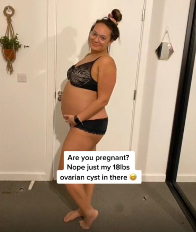 女子肚腩變大驚揭患卵巢癌！驗出18磅腫瘤相等保齡球！以為一般長胖延誤求醫！