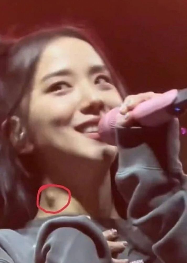 Jisoo驚見「頸腫一塊」嚇壞粉絲！影相刻意遮蓋右頸？疑壓力大健康亮紅燈！