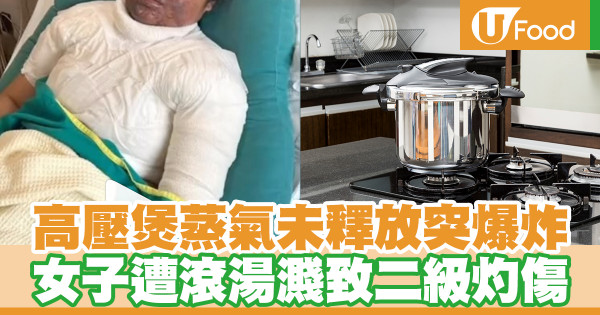 高壓煲蒸氣未釋放突爆炸 女子遭滾湯濺致二級灼傷