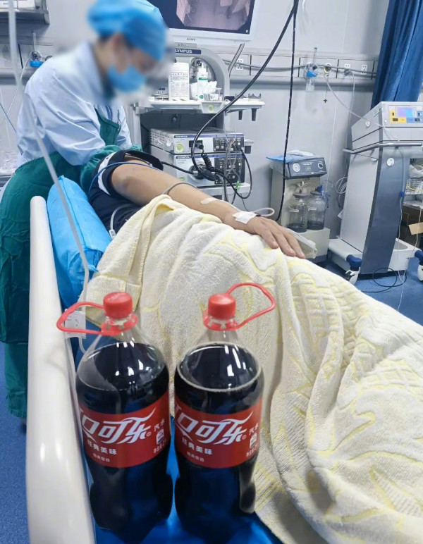 生胃結石醫生藥單開兩支大可樂 男子連續飲一星期後胃結石消失