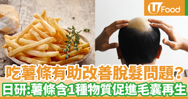 吃薯條有助改善脫髮問題？　日本研究：快餐店薯條含有1種物質可促進毛囊再生