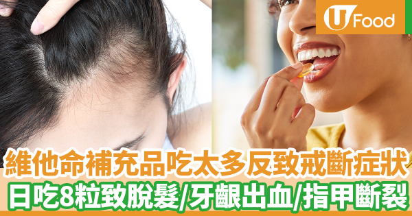 維他命補充品吃太多反而會導致戒斷症狀! 一日吃8粒維他命C導致脫髮/牙齦出血/指甲斷裂
