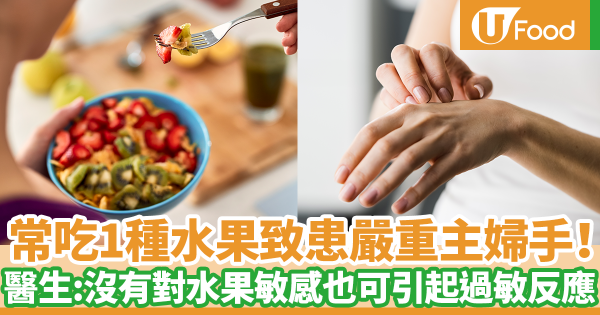 常吃一種水果導致患上嚴重主婦手！　醫生：即使沒有對水果敏感也可以引起過敏反應