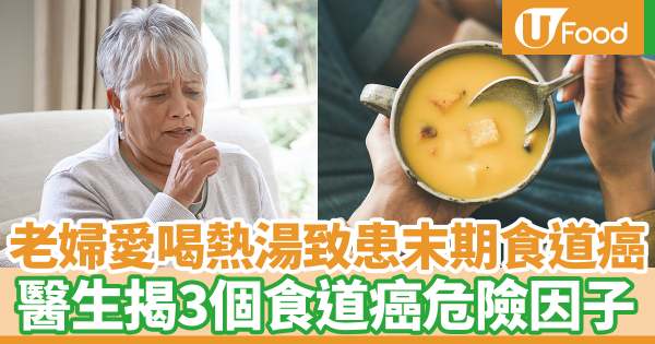老婦愛喝熱湯致患上末期食道癌　醫生揭3個食道癌危險因子
