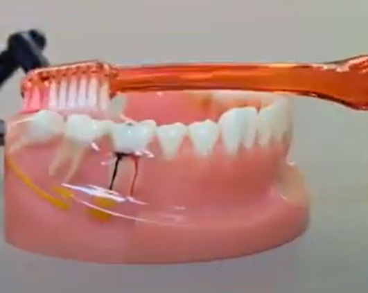 牙刷幾耐需要換？牙醫教你目測方法知幾時