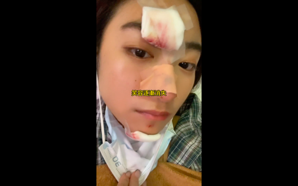 J2女藝人黃紫恩街頭發生恐怖意外臉部直撼石屎地 血淋淋傷勢曝光險破相毀容
