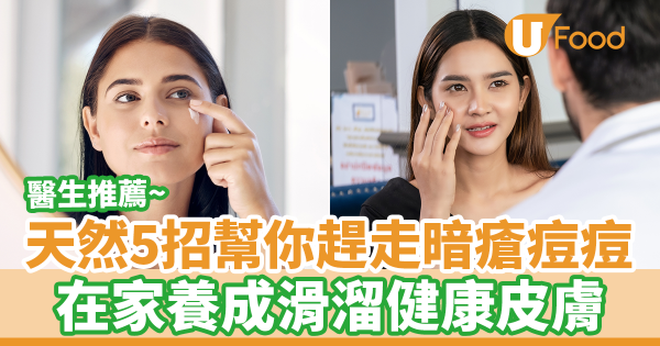 醫生推薦天然5招幫你趕走暗瘡痘痘　在家養成滑溜健康皮膚