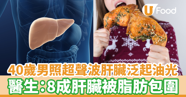 40歲男照超聲波肝臟泛起油光　肝指數飆破200／8成肝臟被脂肪包圍