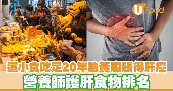 這小食吃足20年臉黃腹脹得肝癌 營養師護肝食物排名