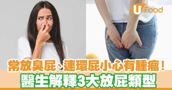 經常放臭屁／連環屁小心有腫瘤！ 醫生解釋3大放屁類型