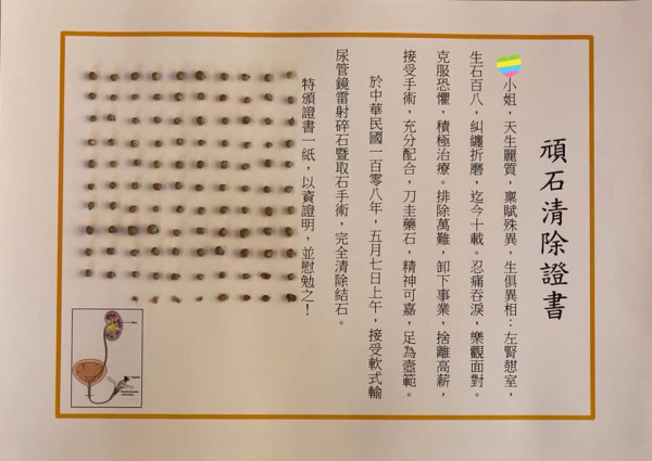 女藝人生108粒腎石 手術做足6小時!醫生揭原因:每日喝呢款健康飲品
