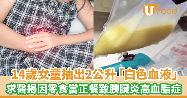 14歲女童抽出2公升「白色血液」求醫揭因零食當正餐致胰臟炎高血脂症