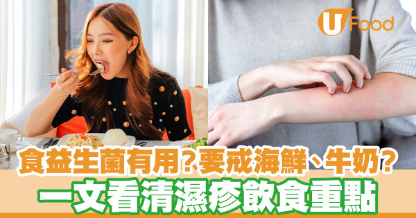 食益生菌有用？要戒海鮮、牛奶？ 一文看清濕疹飲食重點