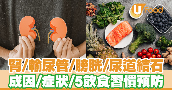 腎臟、輸尿管、膀胱、尿道結石成因＋症狀 5飲食習慣預防尿結石