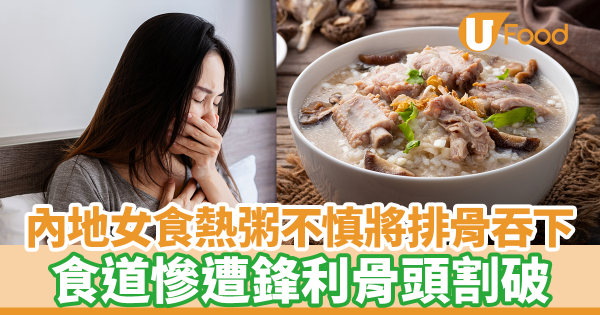 內地女食滾燙熱粥不慎將排骨吞下　食道慘遭尖銳骨頭割破／醫生花40分鐘才取出骨頭