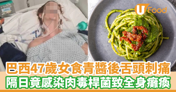 巴西47歲女食青醬後舌頭刺痛 當日確診肉毒桿菌感染致全身癱瘓