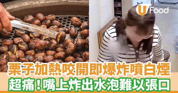 栗子加熱咬開即爆炸噴白煙 女子嘴上炸出水泡超痛難張口
