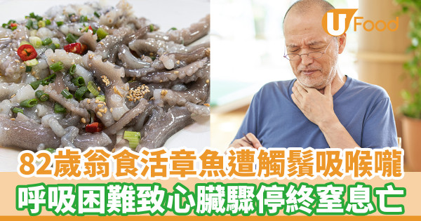 82歲翁食活章魚遭觸鬚吸喉嚨　呼吸困難致心臟驟停終窒息亡