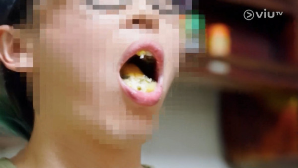 《無制限探險隊》EP10|超嘔心!捉蚊自製非洲劣食食譜 自家製「雙層芝士蚊堡」