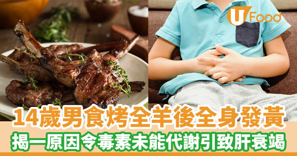 14歲男食烤全羊後全身發黃 揭一原因令毒素未能代謝引致肝衰竭