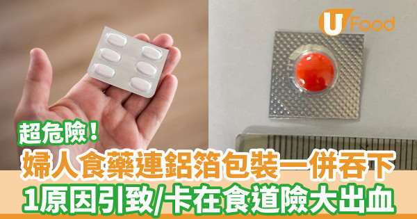 婦人食藥連鋁箔包裝一併吞下 1原因引致/卡在食道險釀成大出血