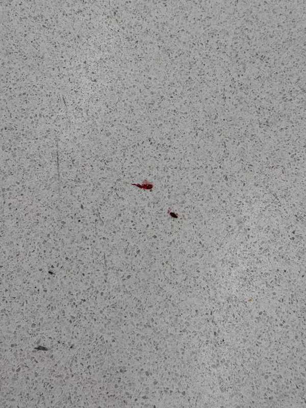 金巴床蝨｜往澳門金巴床蝨滿車 乘客邊坐邊有嘢咬：除鞋超過10隻走出嚟【附金巴回應】 