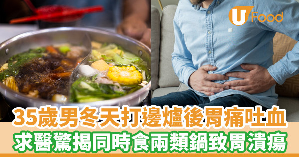 35歲男冬天打邊爐後胃痛吐血 求醫驚揭同時食兩類鍋致胃潰瘍